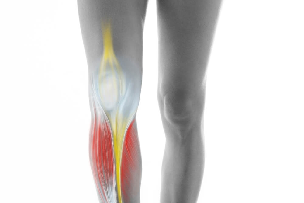 Restless leg syndrome close-up image of human legs with left knee highlighted; yellow, red, and blue medical overlays illustrate knee muscles, tendons, and nerves associated with Restless Leg Syndrome for vein treatment education at Nelson Vein Clinic Cleveland Ohio.