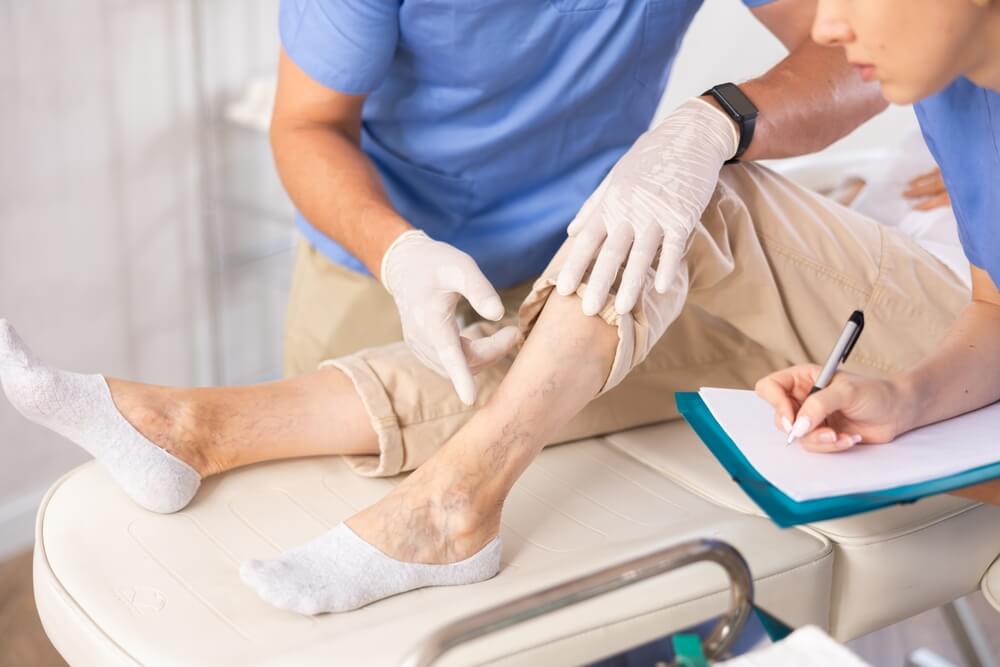 Vein specialist at Nelson Vein Clinic in Cleveland, Ohio examining patient's lower leg for varicose veins while medical assistant records notes on clipboard; patient lying comfortably on examination bed during spider vein and varicose vein assessment.
