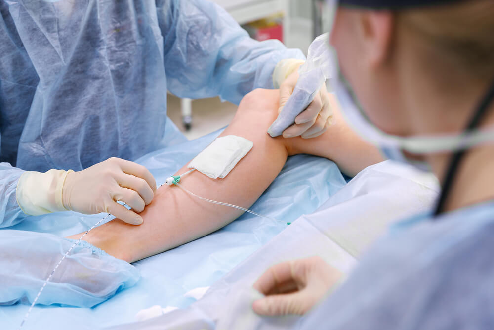 Team of vein specialists at Nelson Vein Clinic in Cleveland, Ohio, wearing surgical gloves and gowns, performing minimally invasive varicose vein or spider vein treatment on a patient's leg; medical staff inserting a catheter for advanced vein care procedure near a bandaged area in a modern clinical setting.