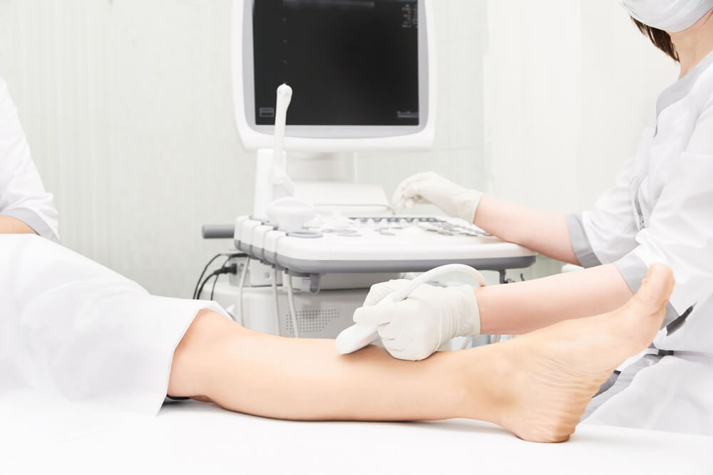 Cleveland vein specialist performing ultrasound scan on patient’s lower leg for varicose and spider vein assessment at Nelson Vein medical clinic examination room.