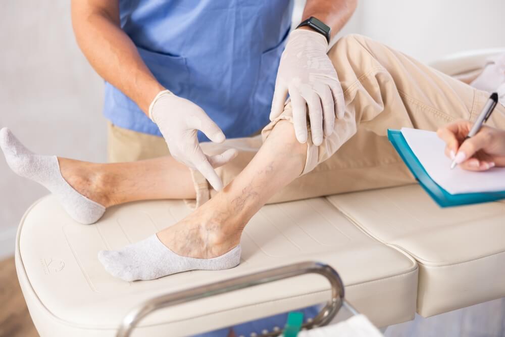 Healthcare provider at Nelson Vein Clinic in Cleveland, Ohio examines patient’s lower leg with visible varicose veins, while assistant takes notes during vein treatment consultation for varicose and spider veins.