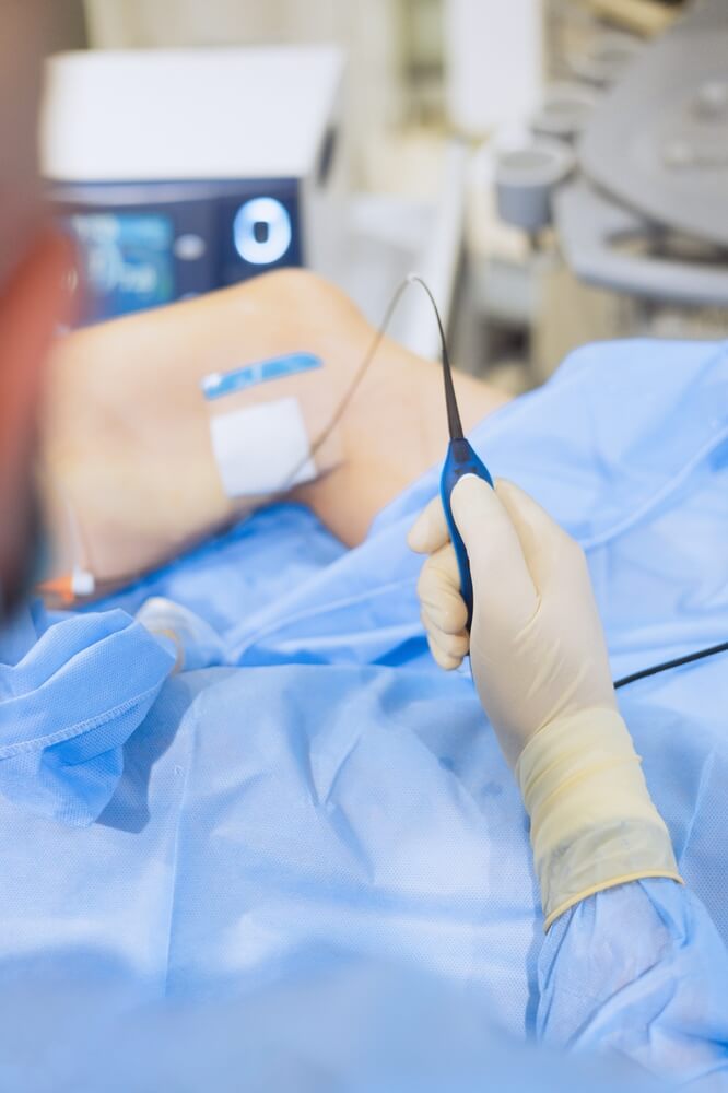 Nelson Vein specialist performing minimally invasive vein treatment on patient’s knee in Cleveland, Ohio clinic operating room.