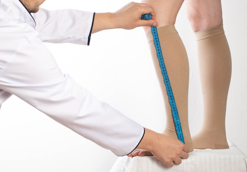 Doctor measuring patient's lower leg with blue tape measure before sclerotherapy at Nelson Vein Clinic in Cleveland, wearing compression stockings.
