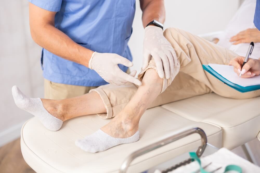 Early care can help prevent worsening vein issues caused by hormones.