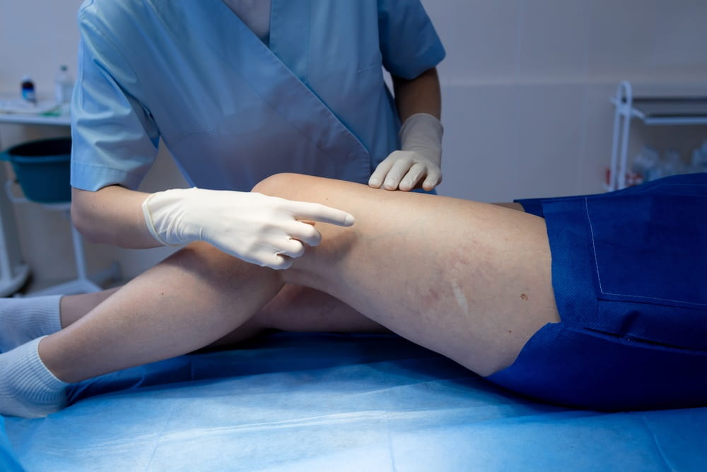 Early evaluation and minimally invasive vein treatments can improve circulation with little downtime.